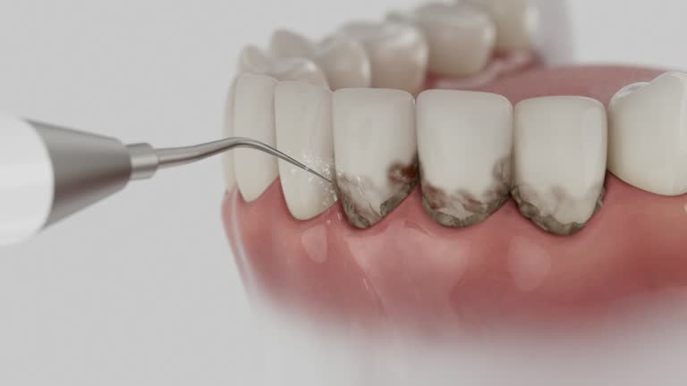 Trusted Root Canal Treatment service in Hasley Canyon, CA - Dentist Open Now